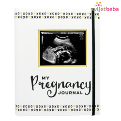 Dnevnik trudnoće