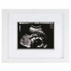 Okvir za sliku sa ultrazvuka